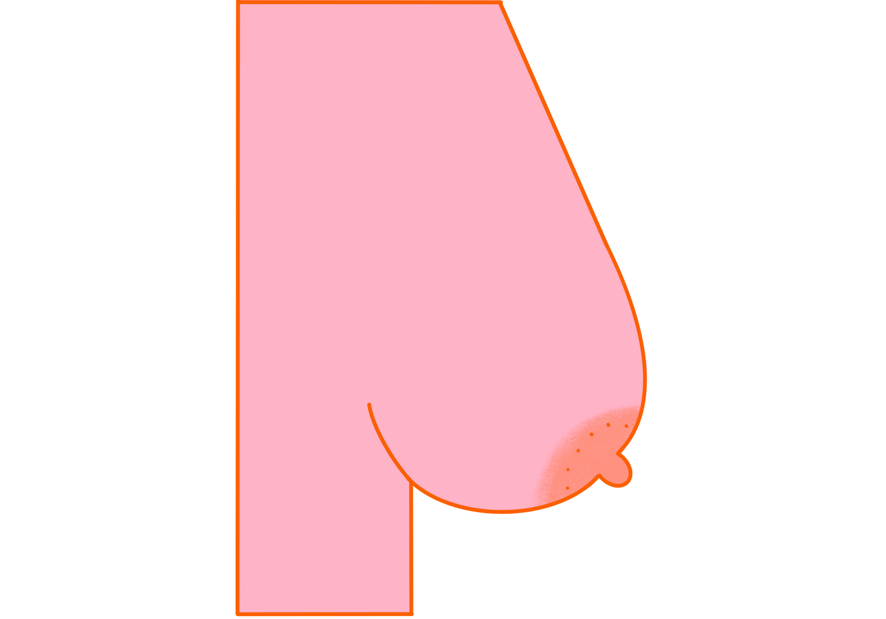 Illustration of breast before using The Buddy